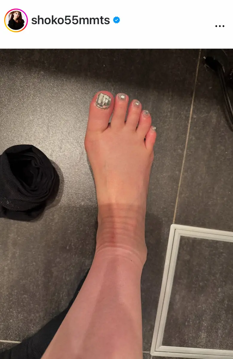 【画像・写真】中川翔子　「べつじんのあし！！やったーーー」悩みの足のむくみ一気に解消で歓喜　効果抜群だったもの