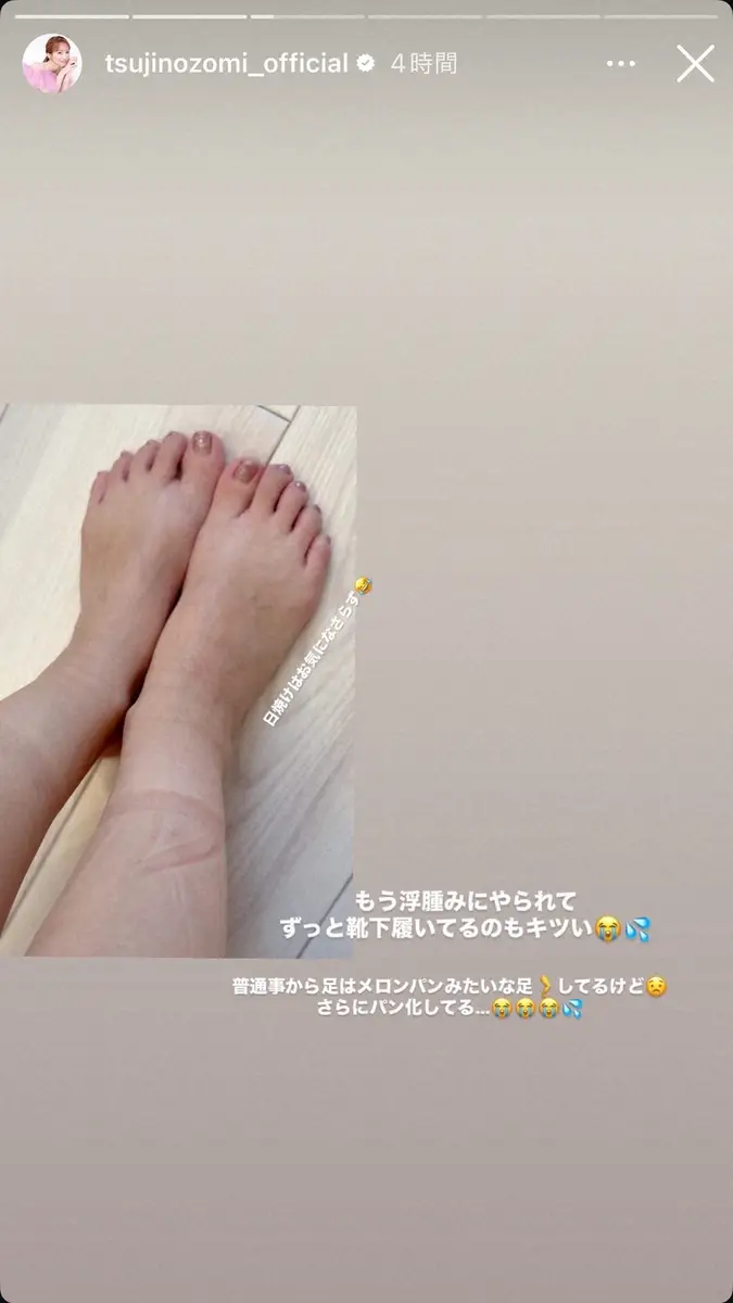 【画像・写真】第5子妊娠中の辻希美　足が「メロンパン化してる…」体の変化明かす　「靴下履いてるのキツい」