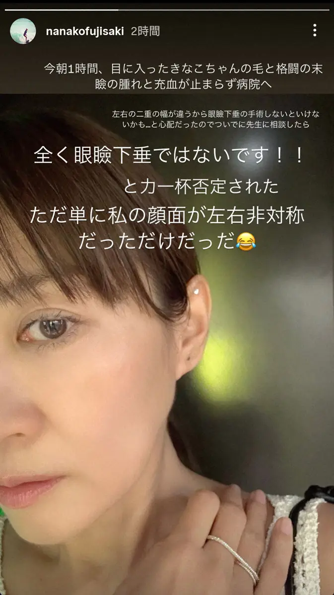 【画像・写真】47歳・藤崎奈々子　まぶたの腫れと充血治まらず病院へ、先生に相談した眼瞼下垂については…