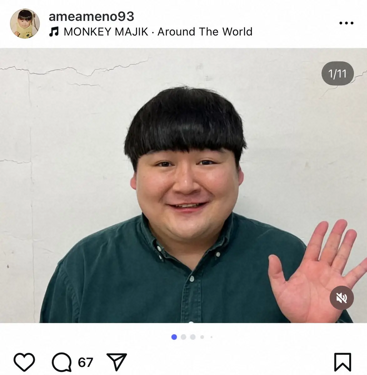 【画像・写真】吉本芸人・雨野宮将明　「鼻中隔湾曲症」「肥厚性鼻炎」で手術＆入院を報告　「右の鼻の中が…」