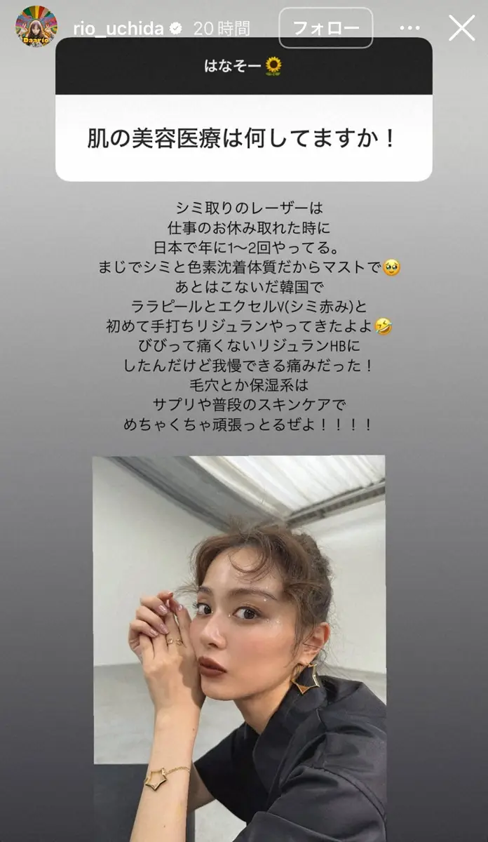 【画像・写真】内田理央　美容医療を赤裸々告白　施術内容、頻度明かし「めちゃくちゃ頑張っとるぜよ！！！！」