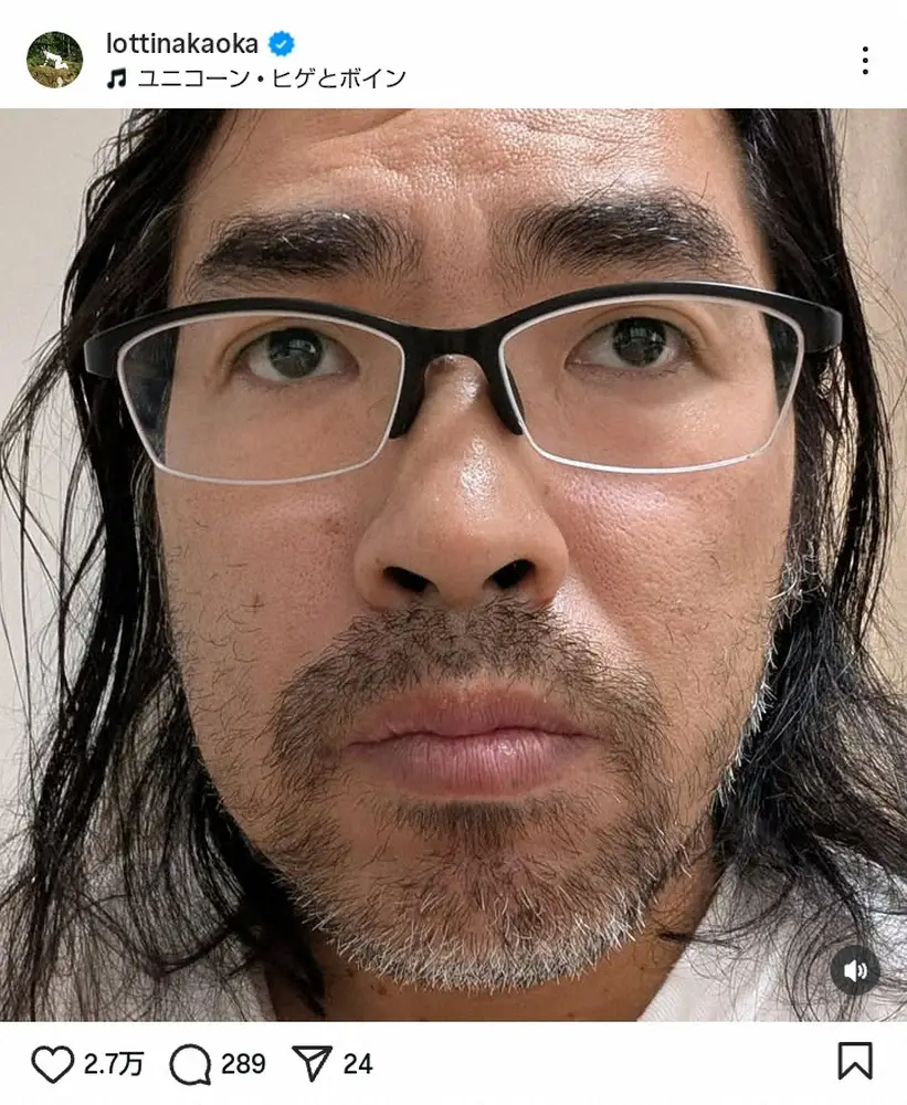 【画像・写真】「痩せたね」腰骨折で全治数カ月のロッチ中岡　“激変”の近影に衝撃「渋くてカッコいい」「イケメンやん」