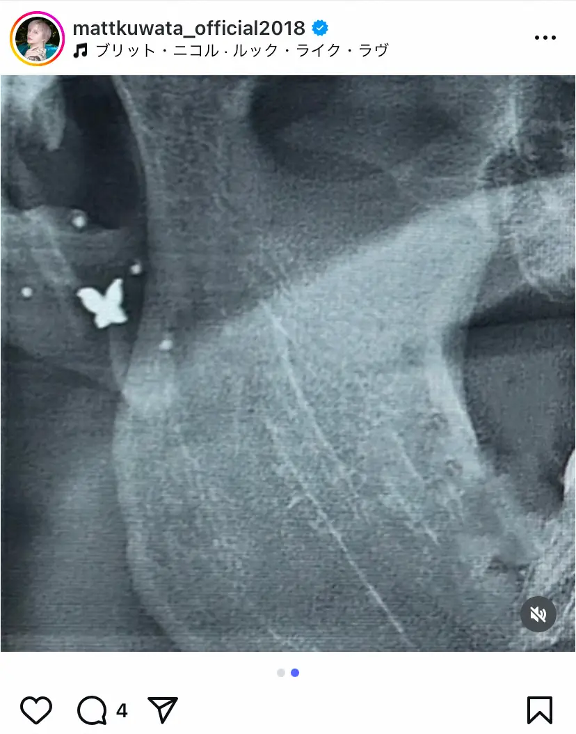 【画像・写真】Matt　流行の耳つぼジュエリーに大興奮！横顔ショット＆スキャン写真披露「かわいいいいい」