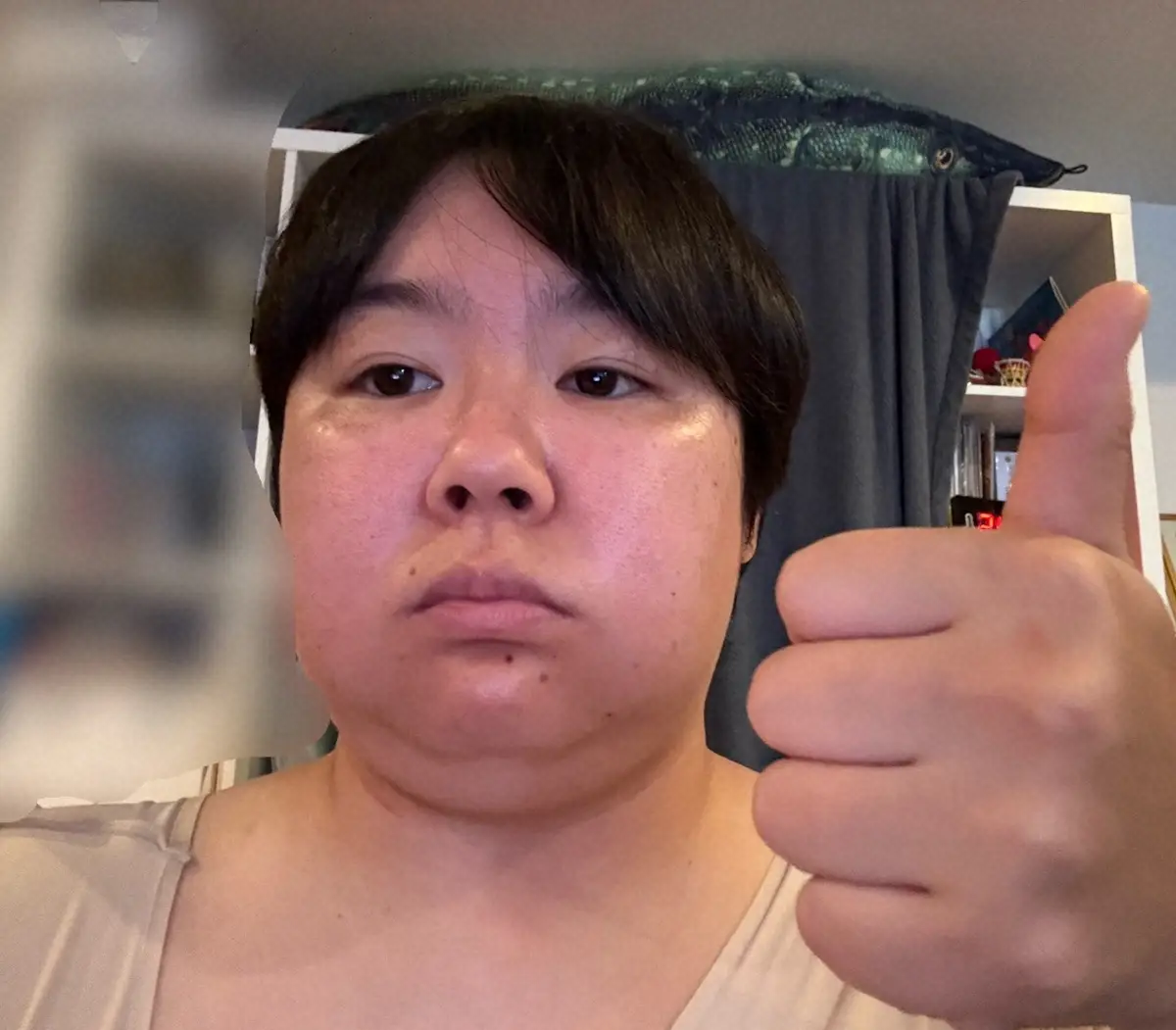 【画像・写真】やす子　親知らず3本抜歯、衝撃の腫れ披露も思わぬ反響　ある人物に似てると話題に