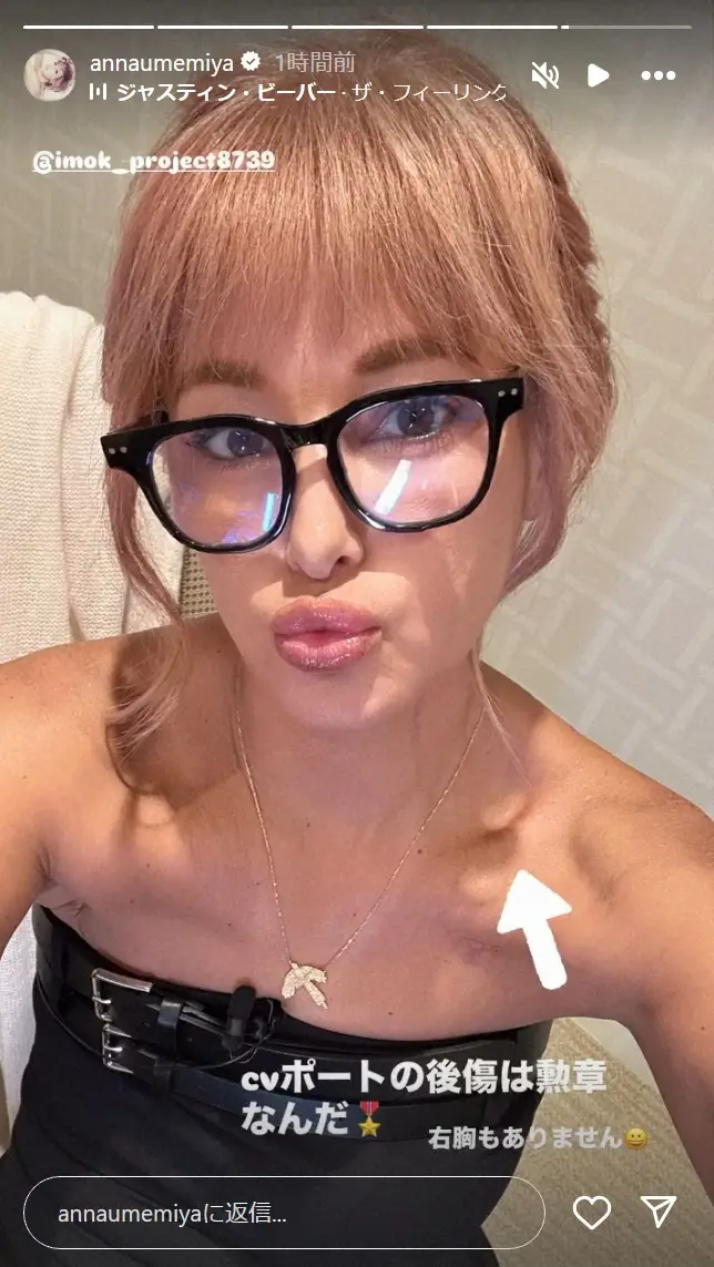 【画像・写真】梅宮アンナ「勲章なんだ」乳がん治療の傷跡公開　11月に右胸全摘手術