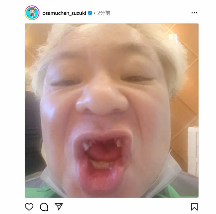 【画像・写真】鈴木おさむ氏「調子が悪く」急きょ歯茎の緊急手術「血液で作った歯の素的なものを…」