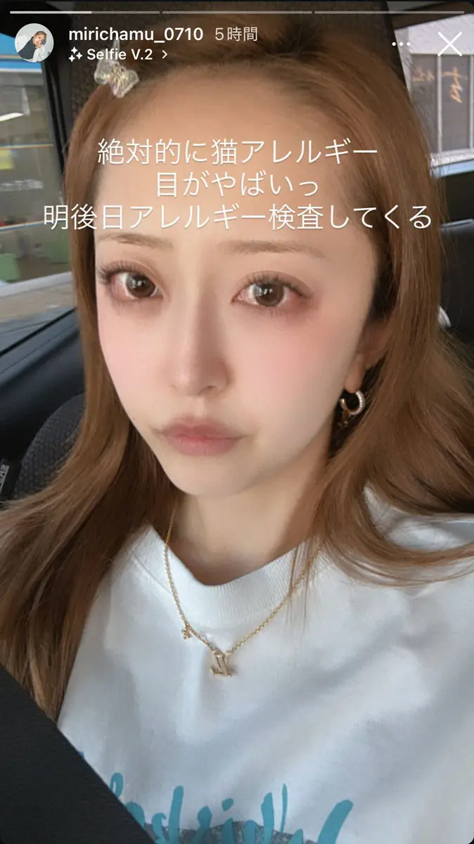 【画像・写真】みりちゃむ　目が真っ赤に充血「明後日検査してくる」　原因は「絶対的に…」