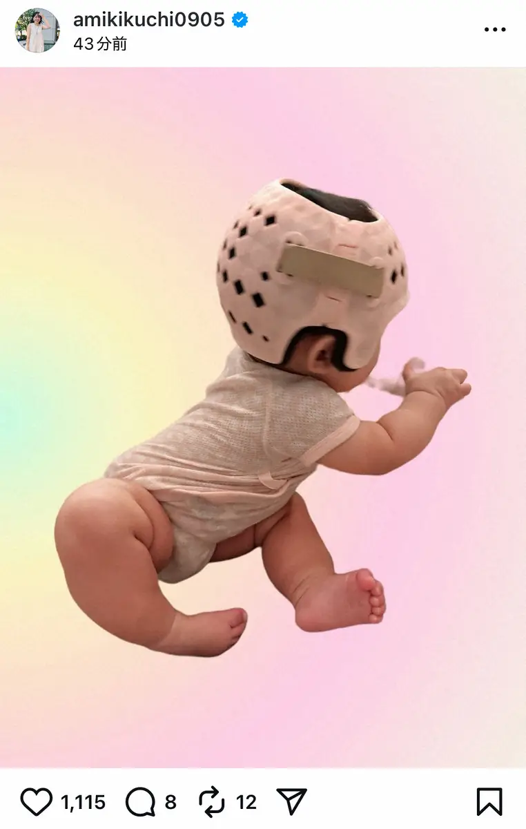 【画像・写真】菊地亜美　生後6カ月次女のヘルメット矯正開始を報告　共感＆応援の声集まる　