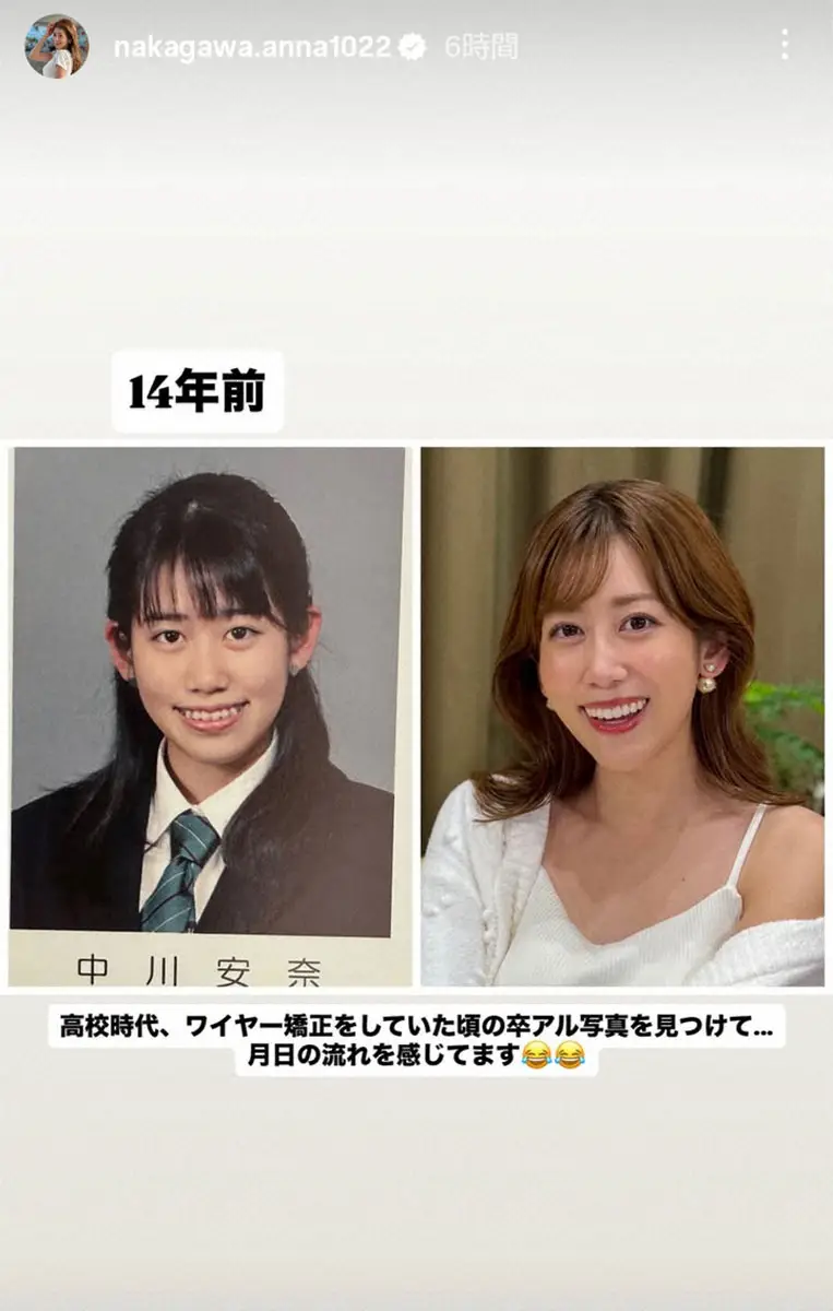 【画像・写真】中川安奈　歯列矯正していた14年前の高校の卒アル写真を披露「月日の流れを感じてます」