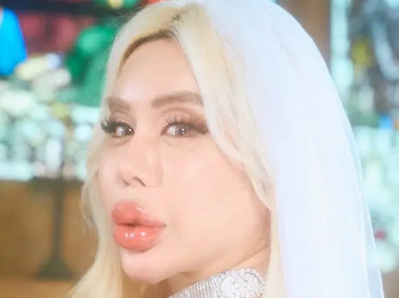 【画像・写真】アレン様　「基本ベースが…」ギャラ最低ラインぶっちゃけ　共演者衝撃「えぇー!?」