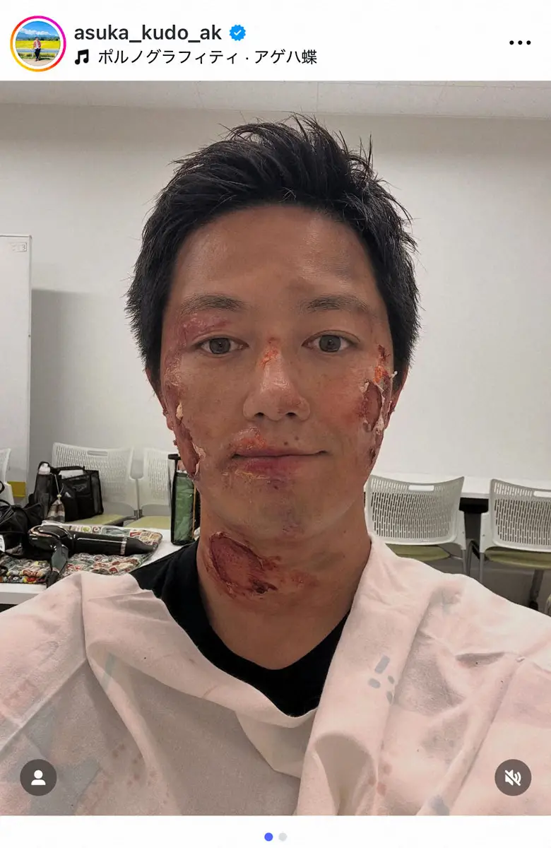 【画像・写真】工藤阿須加　顔面大ケガ…リアルすぎる特殊メイクにフォロワーも衝撃「痛々しい」「すごい」