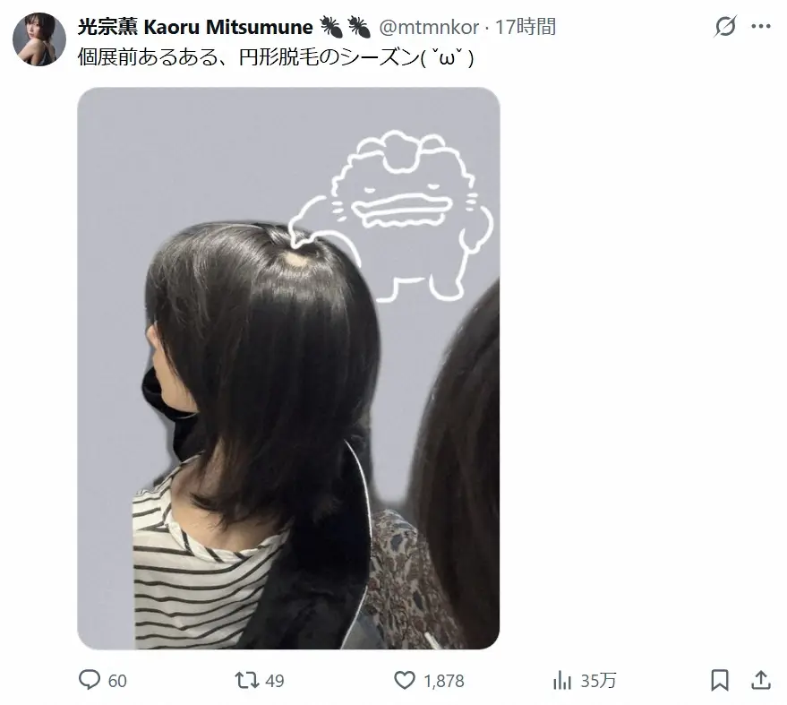 【画像・写真】光宗薫　個展直前「円形脱毛」告白　頭頂部写真に心配の声「無理しすぎないで」「心身を削って…」