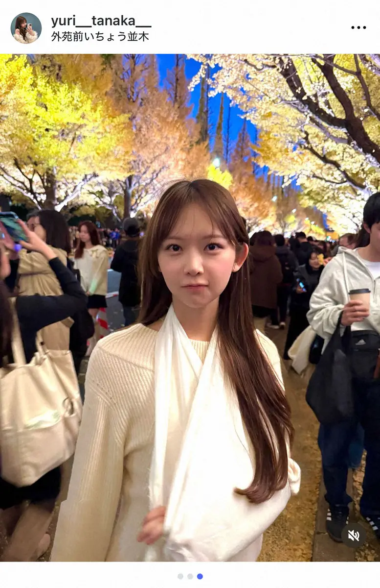 【画像・写真】元ミス東大23歳タレント「人生初骨折しました」左腕をつったショットに「無理なさらず」