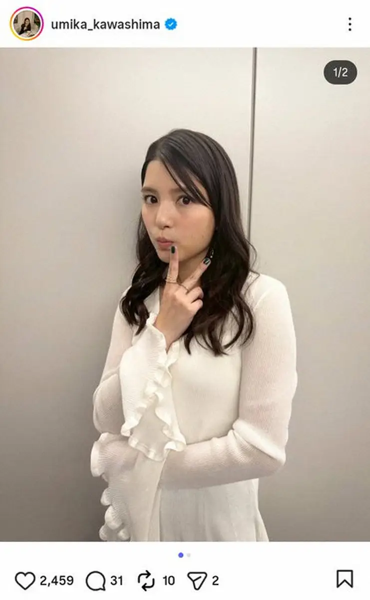 【画像・写真】川島海荷　アナフィラキシーで救急搬送、心配の声に「今は無事ピンピンしてますし、ぜんぜん大丈夫！」