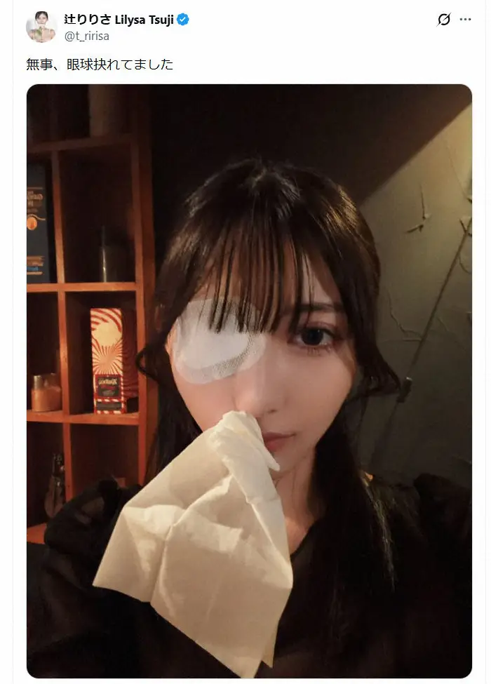 【画像・写真】28歳グラドル「眼球抉れてました」　衝撃告白&自撮り写真に心配の声続々「ええええ」「一体何が…」