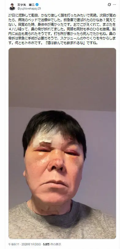 【画像・写真】人気声優が衝撃告白「おでこがえぐれて、鼻の骨が折れた」　泥酔し転倒　痛々しい姿に心配の声殺到