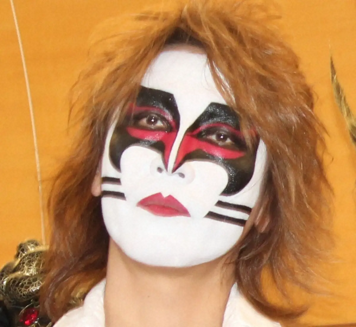 【画像・写真】「聖飢魔Ⅱ」ギターのジェイル大橋　頚髄症で手術　症状悪化で頚椎椎間板の切除と、不安定脊椎を固定