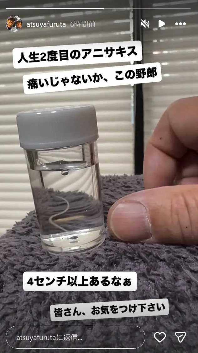 【画像・写真】古田敦也氏　「人生2度目のアニサキス」激痛に嘆き　除去した虫体公開「4センチ以上ある」