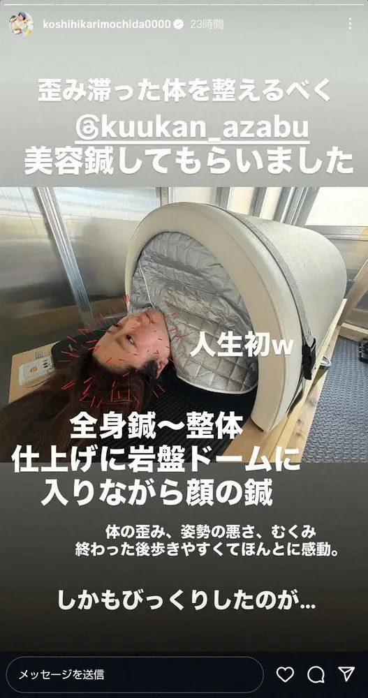 【画像・写真】“100キロ女子”餅田コシヒカリ「刺さるのかな」美容鍼中の背中にツッコミ「なだらか過ぎるって」