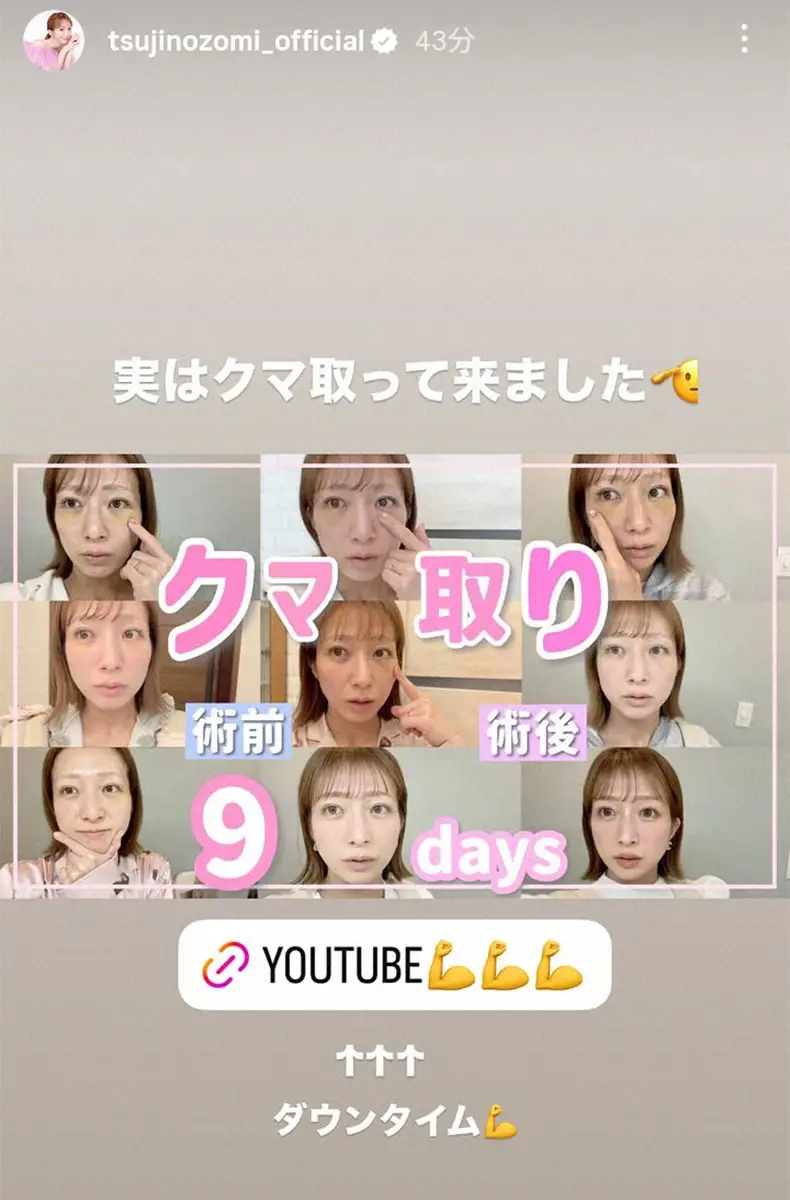 【画像・写真】辻希美　美容整形を受けたことを告白　仕上がりに満足「薄くなったんじゃないかな、やってよかった」　