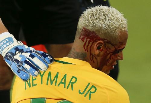 ボリビア戦で相手選手と接触し顔面から血をながすブラジル代表ＦＷネイマール（ＡＰ）