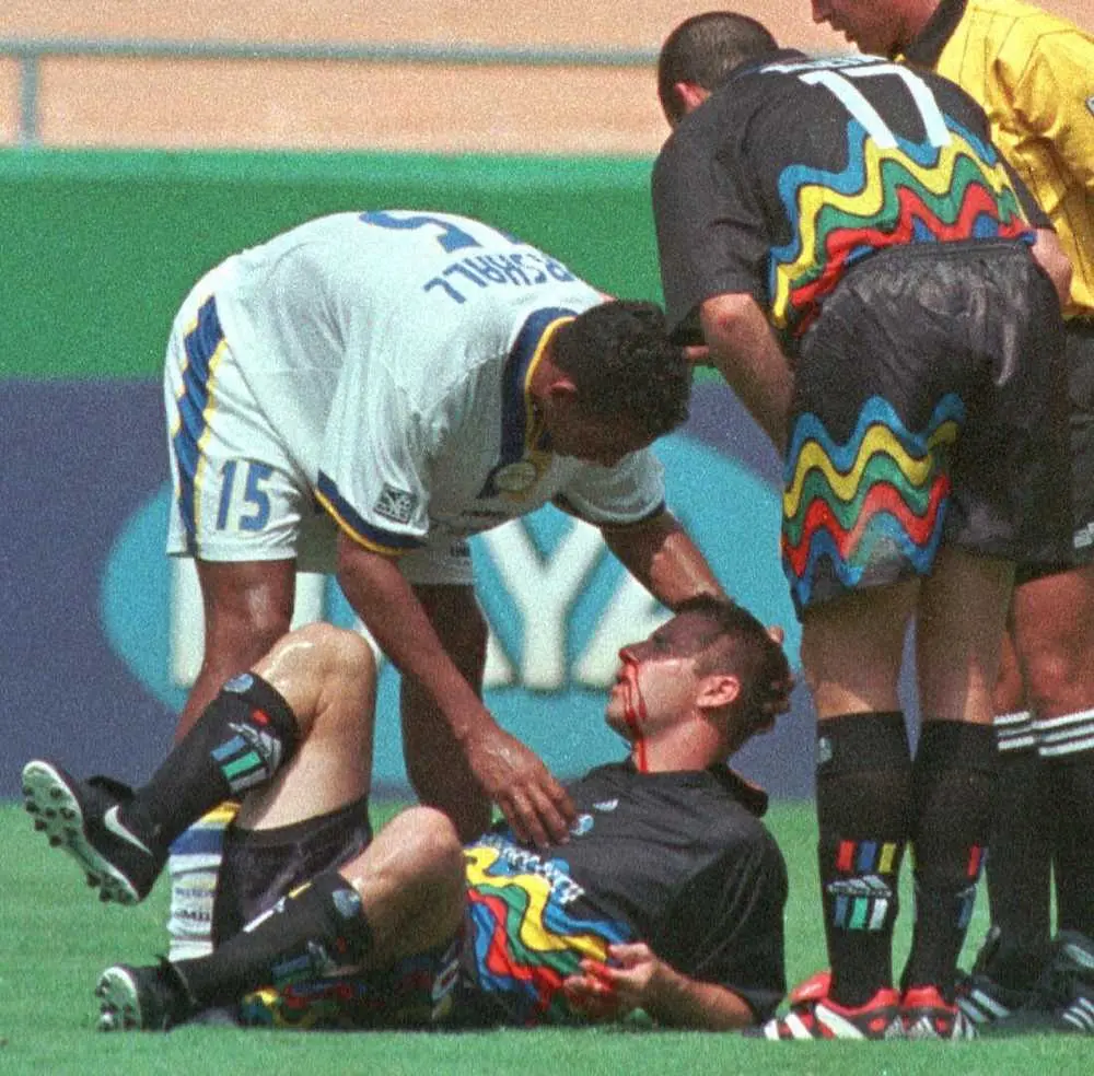 1999年、試合中に相手選手と激突して鼻から出血したバーミリオン（AP）