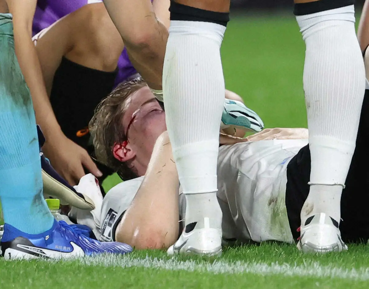 【画像・写真】浦和スコルジャ監督「CKからの失点は影響が大きかった」　復帰後初スタメンMF原口元気の交代にも言及