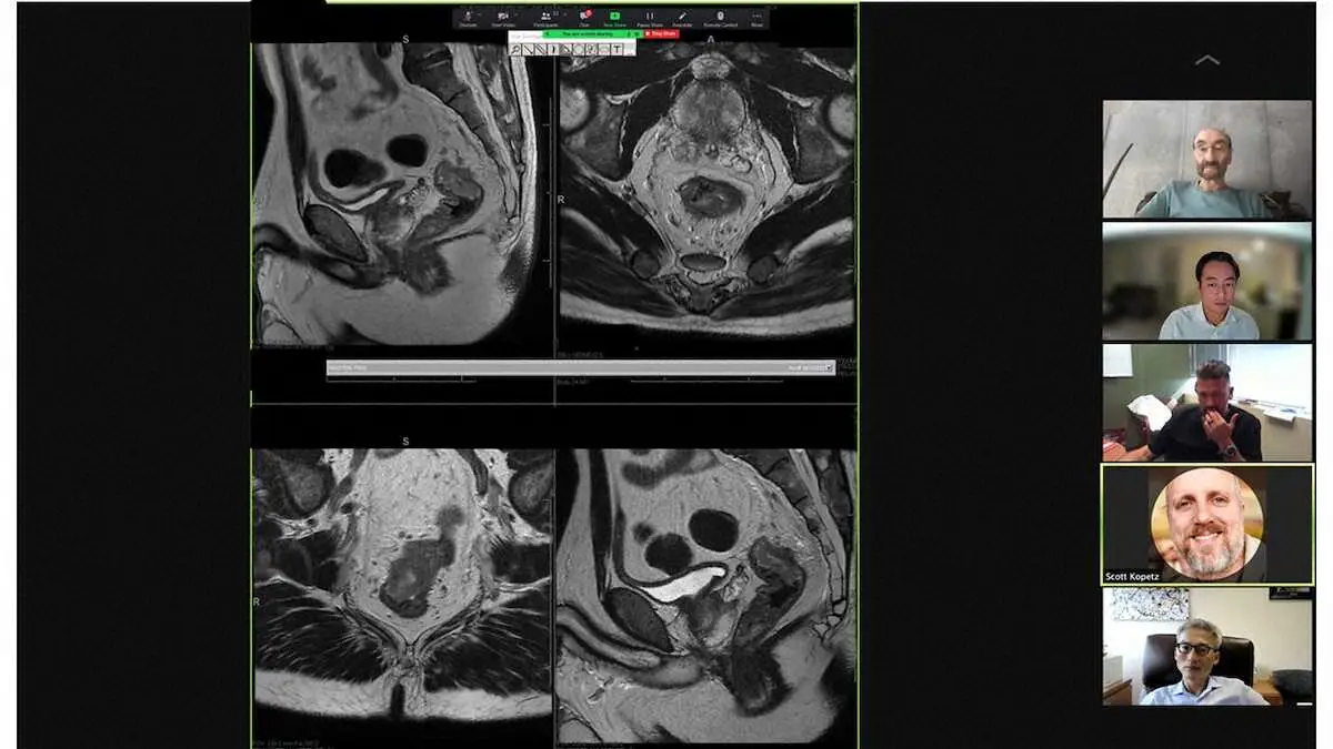 【画像・写真】各科のエキスパートが経験と知識持ちあう多科合同の症例会議　チーム医療で目指す再発大腸がんの完治