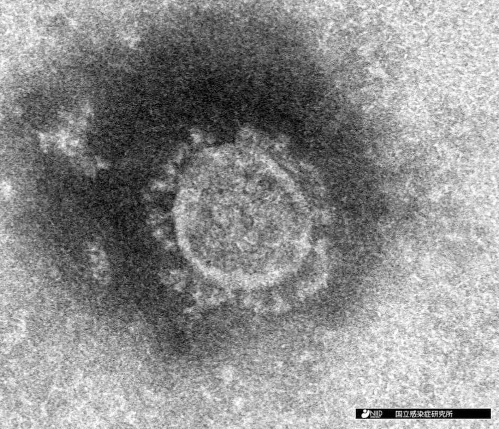 分離された新型コロナウイルスの電子顕微鏡写真（国立感染症研究所提供）