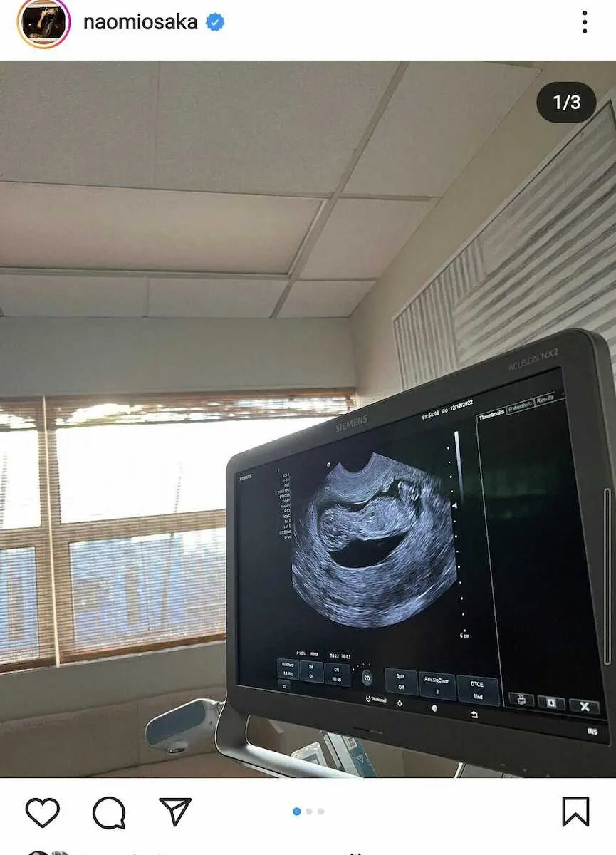 【画像・写真】妊娠したことをSNSで公表した大坂（大坂なおみ公式インスタグラムから）