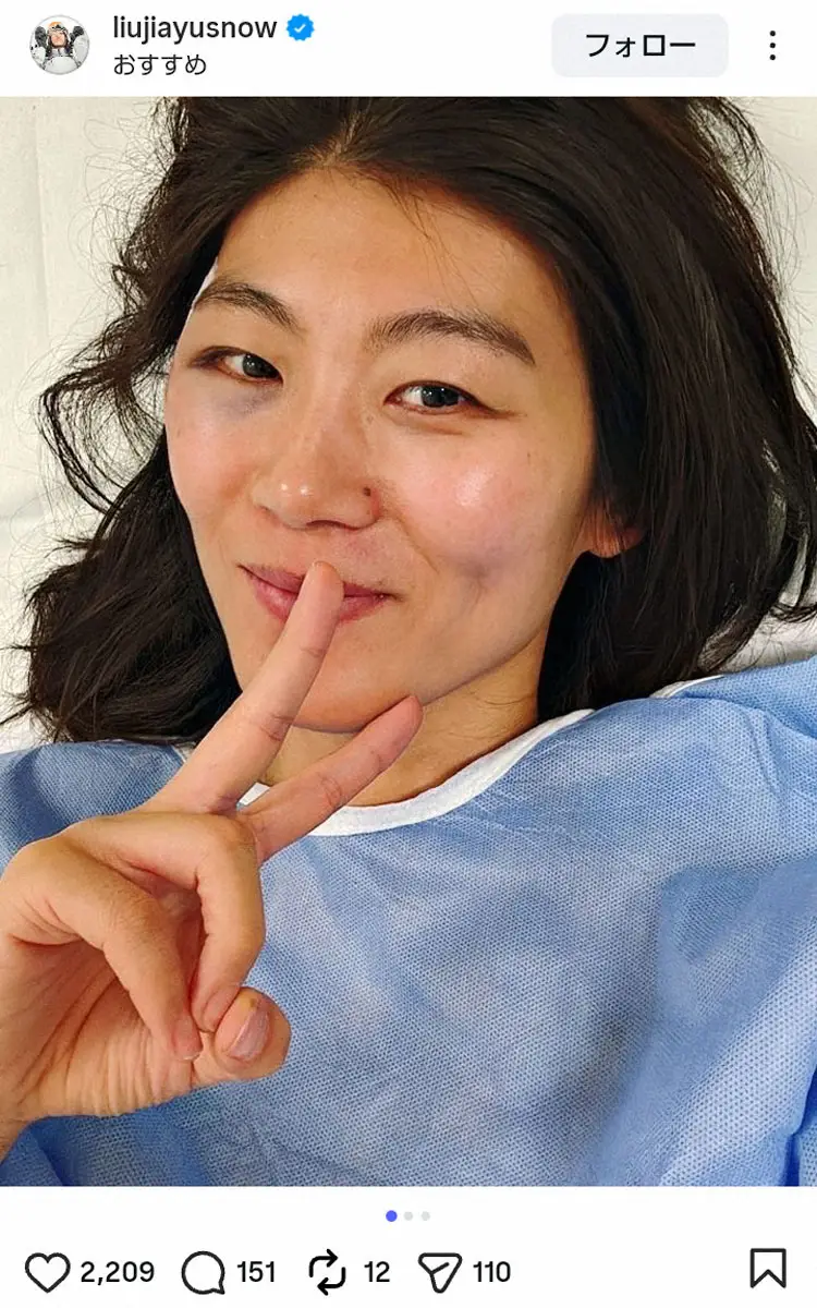 【画像・写真】【スノボ】転倒搬送の中国女子選手、退院を報告「数針縫っただけ」あざ残るも笑顔でピースサイン